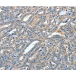 Immunohistochemistry - ANGPT1 Antibody from Signalway Antibody (35618) - Antibodies.com