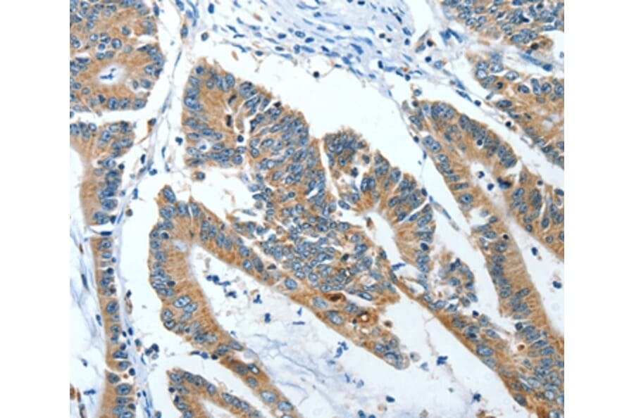 Immunohistochemistry - ANGPT1 Antibody from Signalway Antibody (35618) - Antibodies.com