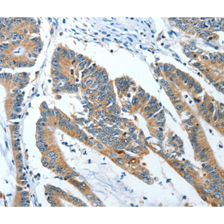 Immunohistochemistry - ANGPT1 Antibody from Signalway Antibody (35618) - Antibodies.com