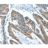 Immunohistochemistry - ANGPT1 Antibody from Signalway Antibody (35618) - Antibodies.com
