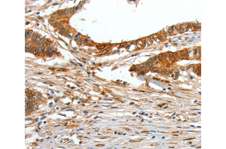 Immunohistochemistry - COL1A2 Antibody from Signalway Antibody (35634) - Antibodies.com