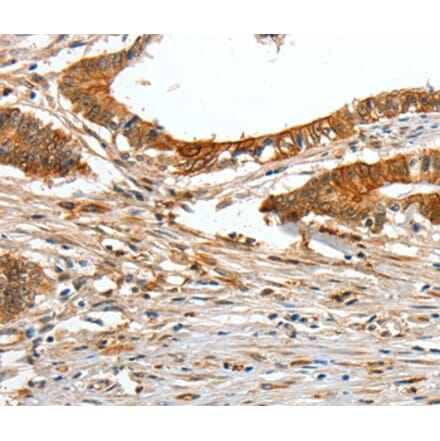 Immunohistochemistry - COL1A2 Antibody from Signalway Antibody (35634) - Antibodies.com