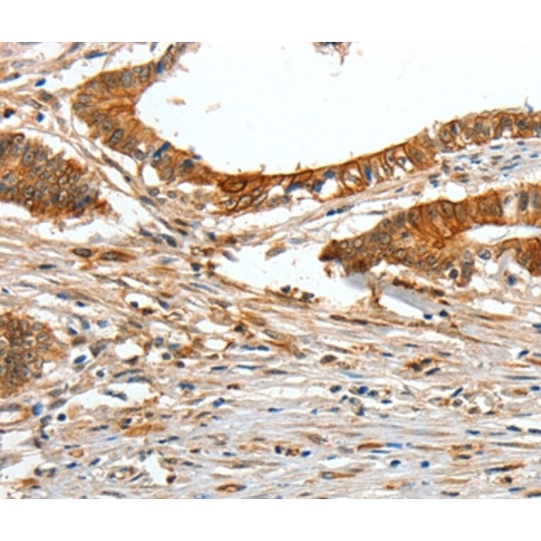 Immunohistochemistry - COL1A2 Antibody from Signalway Antibody (35634) - Antibodies.com