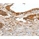Immunohistochemistry - COL1A2 Antibody from Signalway Antibody (35634) - Antibodies.com