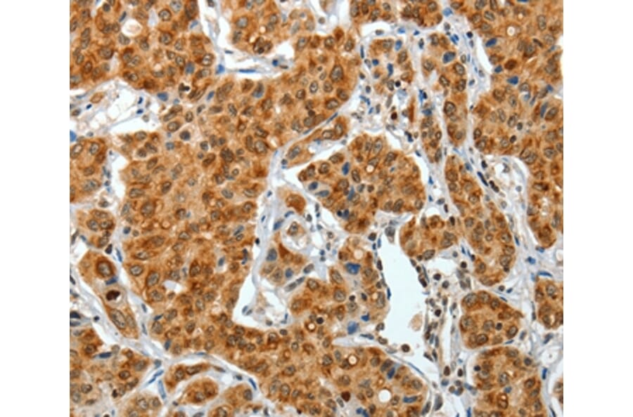 Immunohistochemistry - COL1A2 Antibody from Signalway Antibody (35634) - Antibodies.com