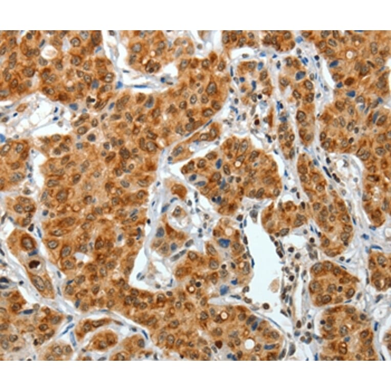 Immunohistochemistry - COL1A2 Antibody from Signalway Antibody (35634) - Antibodies.com