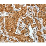 Immunohistochemistry - COL1A2 Antibody from Signalway Antibody (35634) - Antibodies.com