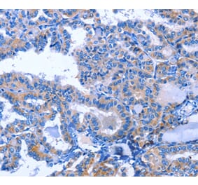 Immunohistochemistry - ACVR2B Antibody from Signalway Antibody (35646) - Antibodies.com
