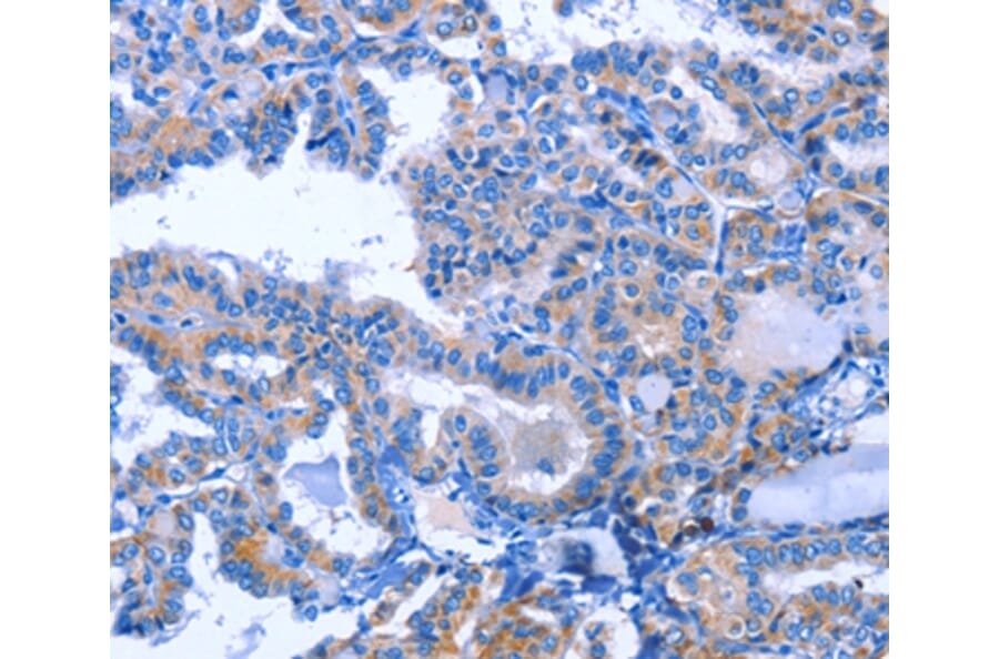 Immunohistochemistry - ACVR2B Antibody from Signalway Antibody (35646) - Antibodies.com