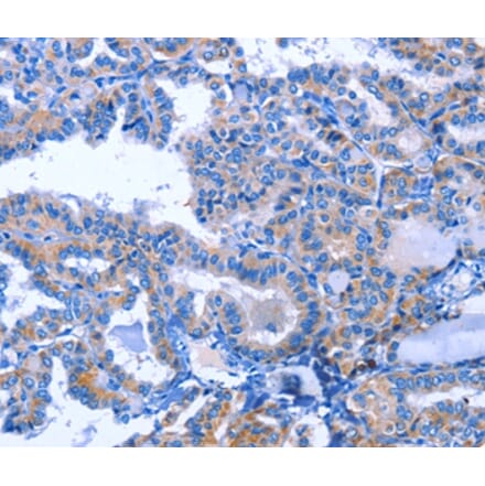 Immunohistochemistry - ACVR2B Antibody from Signalway Antibody (35646) - Antibodies.com