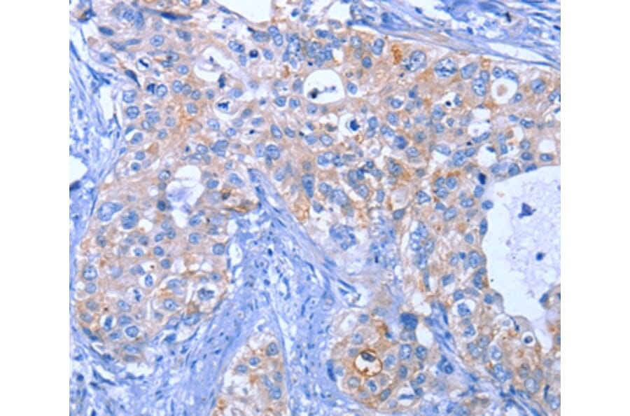 Immunohistochemistry - ACVR2B Antibody from Signalway Antibody (35646) - Antibodies.com