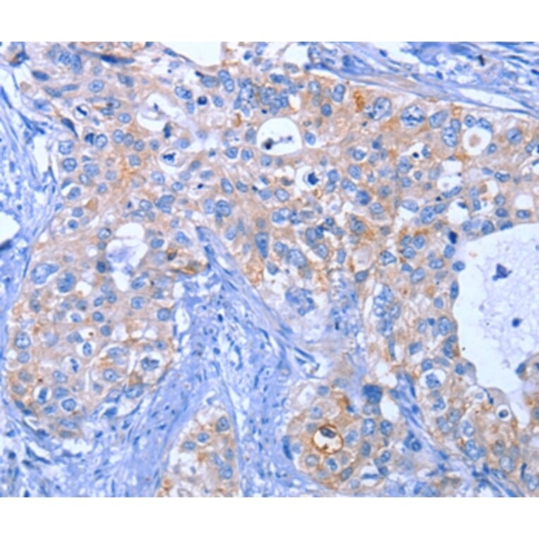 Immunohistochemistry - ACVR2B Antibody from Signalway Antibody (35646) - Antibodies.com