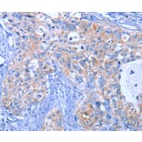 Immunohistochemistry - ACVR2B Antibody from Signalway Antibody (35646) - Antibodies.com