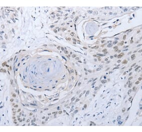 Immunohistochemistry - CAMK2B Antibody from Signalway Antibody (35659) - Antibodies.com