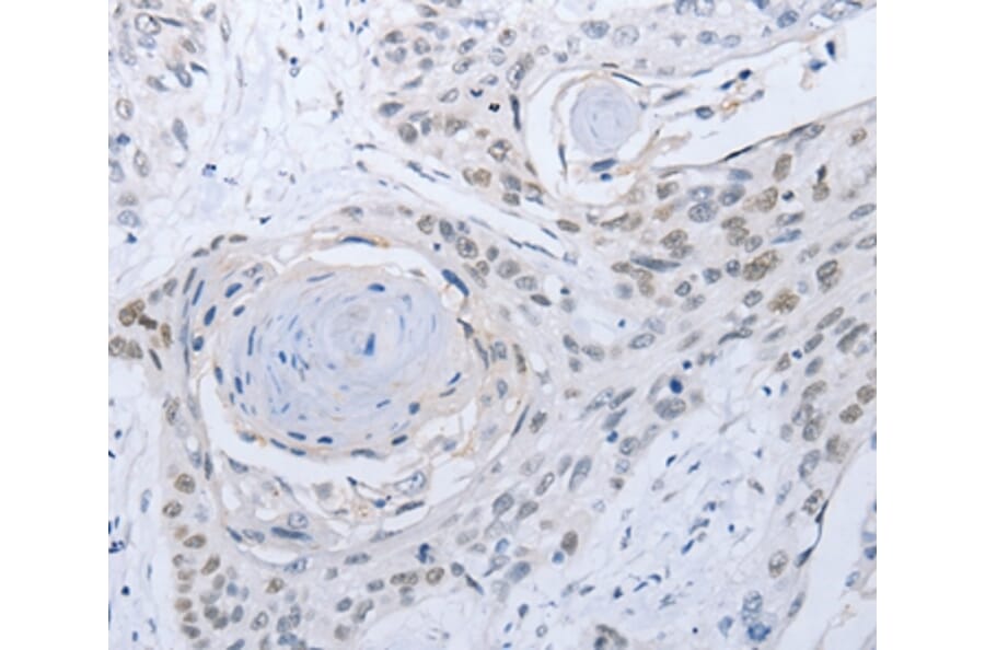 Immunohistochemistry - CAMK2B Antibody from Signalway Antibody (35659) - Antibodies.com