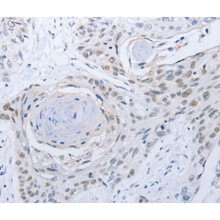 Immunohistochemistry - CAMK2B Antibody from Signalway Antibody (35659) - Antibodies.com