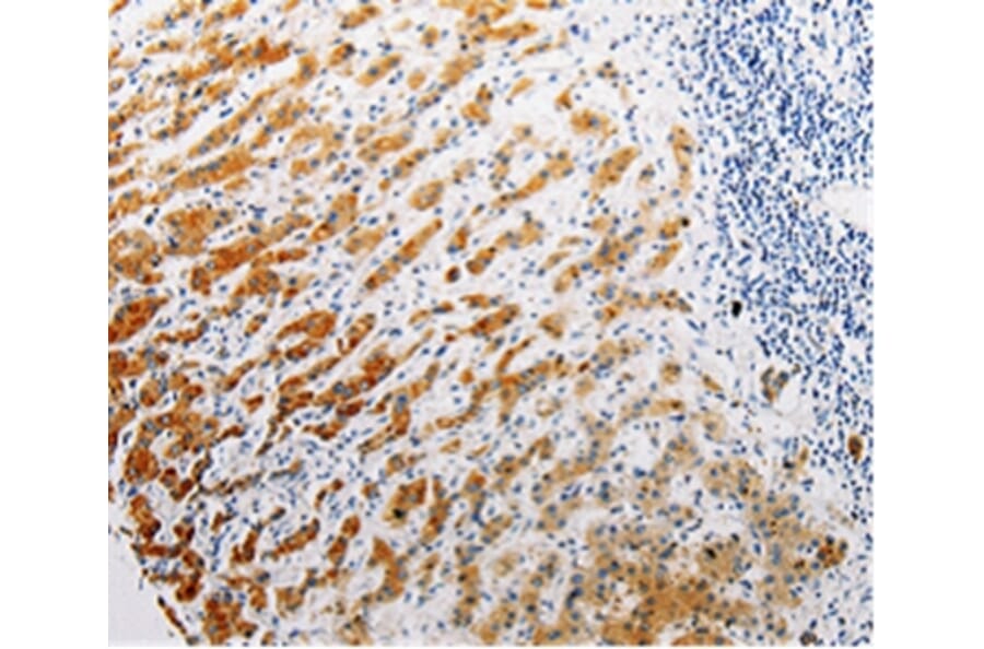 Immunohistochemistry - CLEC1B Antibody from Signalway Antibody (35685) - Antibodies.com