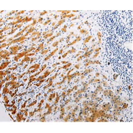 Immunohistochemistry - CLEC1B Antibody from Signalway Antibody (35685) - Antibodies.com
