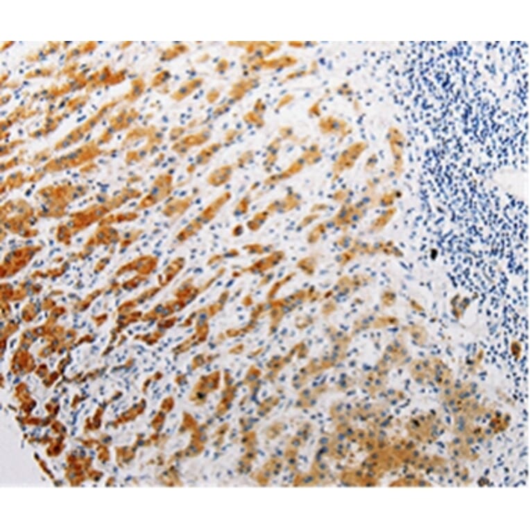 Immunohistochemistry - CLEC1B Antibody from Signalway Antibody (35685) - Antibodies.com