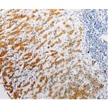 Immunohistochemistry - CLEC1B Antibody from Signalway Antibody (35685) - Antibodies.com