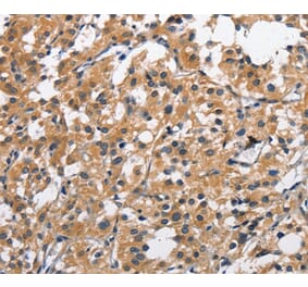 Immunohistochemistry - CLEC2D Antibody from Signalway Antibody (35686) - Antibodies.com