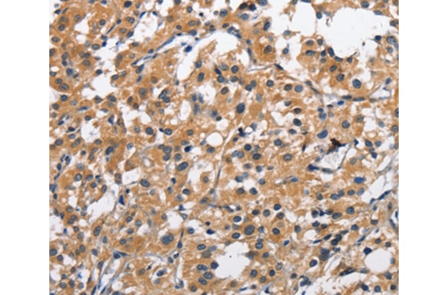 Immunohistochemistry - CLEC2D Antibody from Signalway Antibody (35686) - Antibodies.com