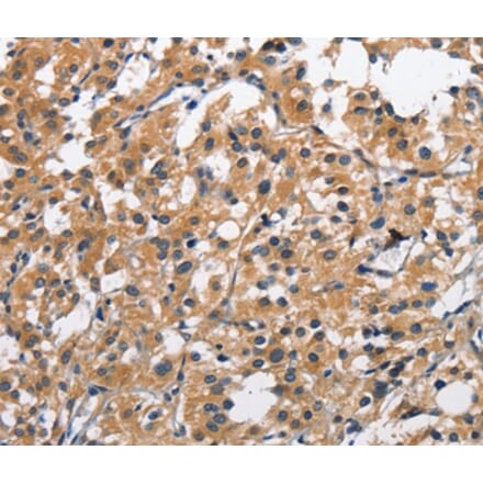 Immunohistochemistry - CLEC2D Antibody from Signalway Antibody (35686) - Antibodies.com