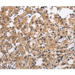 Immunohistochemistry - CLEC2D Antibody from Signalway Antibody (35686) - Antibodies.com
