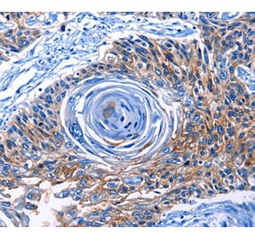 Immunohistochemistry - CLEC2B Antibody from Signalway Antibody (35688) - Antibodies.com
