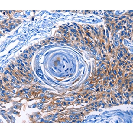 Immunohistochemistry - CLEC2B Antibody from Signalway Antibody (35688) - Antibodies.com