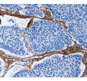 Immunohistochemistry - COL3A1 Antibody from Signalway Antibody (35691) - Antibodies.com