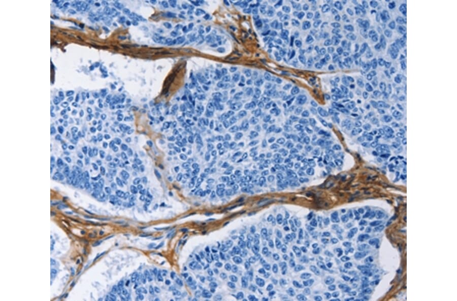 Immunohistochemistry - COL3A1 Antibody from Signalway Antibody (35691) - Antibodies.com