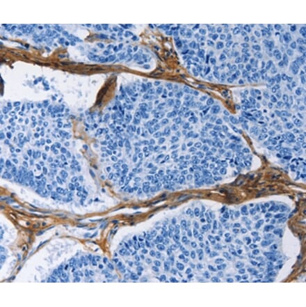 Immunohistochemistry - COL3A1 Antibody from Signalway Antibody (35691) - Antibodies.com