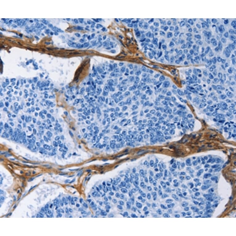 Immunohistochemistry - COL3A1 Antibody from Signalway Antibody (35691) - Antibodies.com