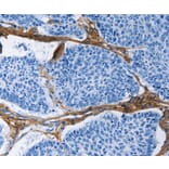 Immunohistochemistry - COL3A1 Antibody from Signalway Antibody (35691) - Antibodies.com