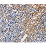 Immunohistochemistry - COL3A1 Antibody from Signalway Antibody (35691) - Antibodies.com