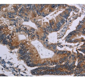 Immunohistochemistry - CLDND1 Antibody from Signalway Antibody (35692) - Antibodies.com