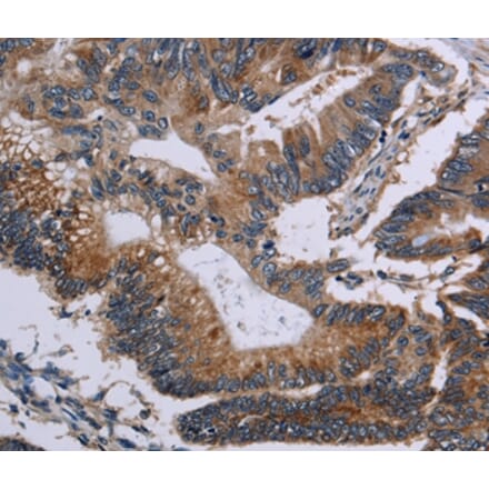 Immunohistochemistry - CLDND1 Antibody from Signalway Antibody (35692) - Antibodies.com