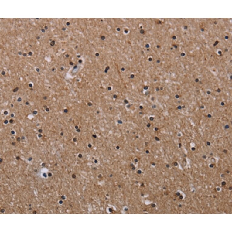 Immunohistochemistry - CLDND1 Antibody from Signalway Antibody (35692) - Antibodies.com
