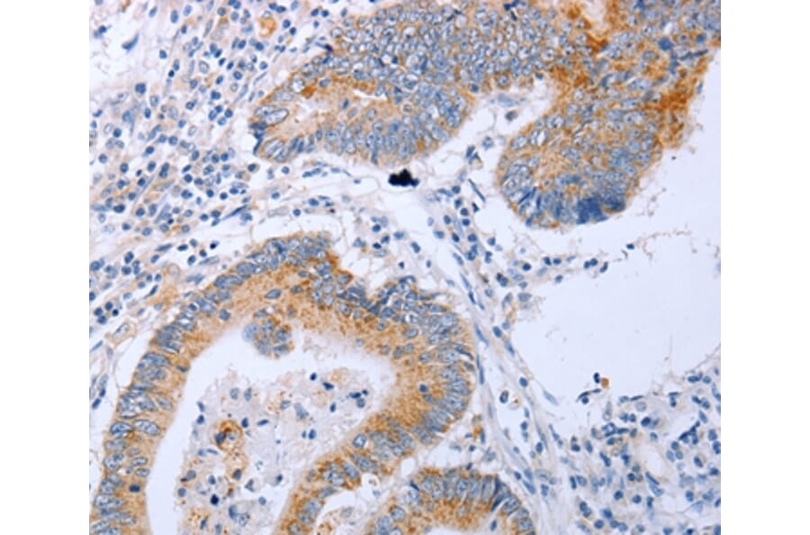 Immunohistochemistry - DNMT3L Antibody from Signalway Antibody (35715) - Antibodies.com