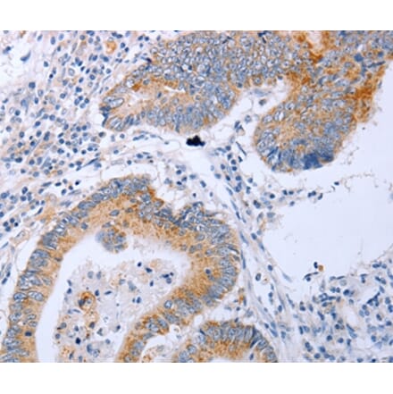 Immunohistochemistry - DNMT3L Antibody from Signalway Antibody (35715) - Antibodies.com