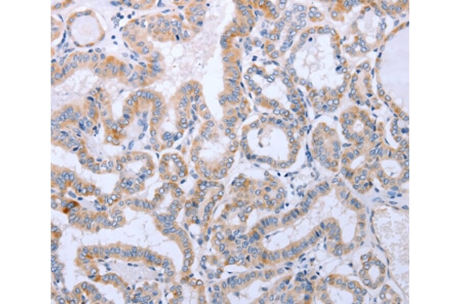 Immunohistochemistry - DNMT3L Antibody from Signalway Antibody (35715) - Antibodies.com