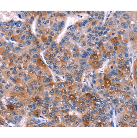 Immunohistochemistry - DUSP13 Antibody from Signalway Antibody (35729) - Antibodies.com