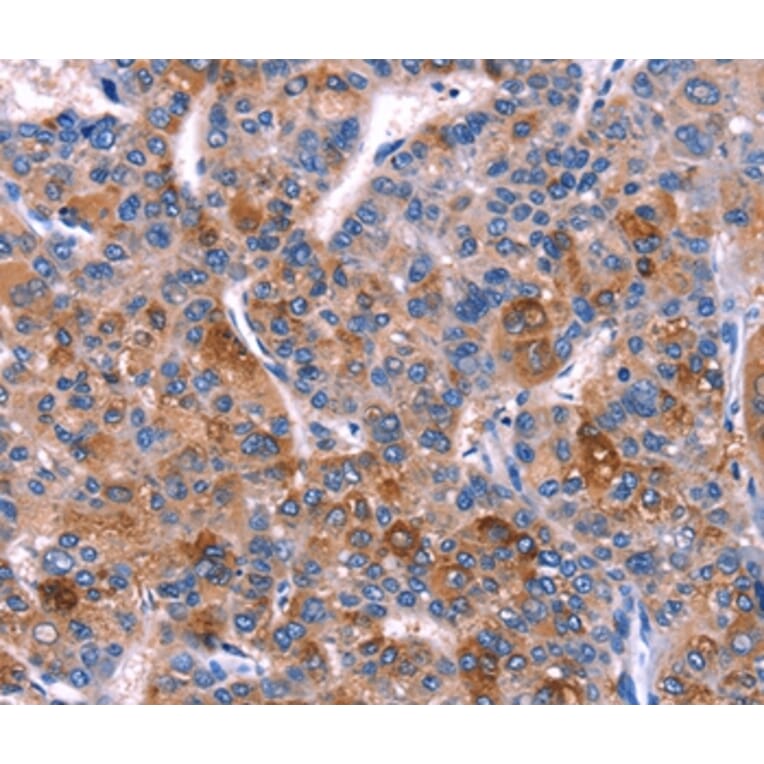 Immunohistochemistry - DUSP13 Antibody from Signalway Antibody (35729) - Antibodies.com