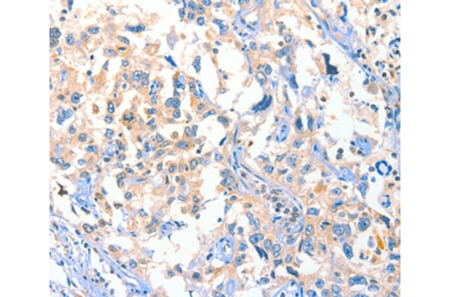 Immunohistochemistry - DUSP14 Antibody from Signalway Antibody (35730) - Antibodies.com