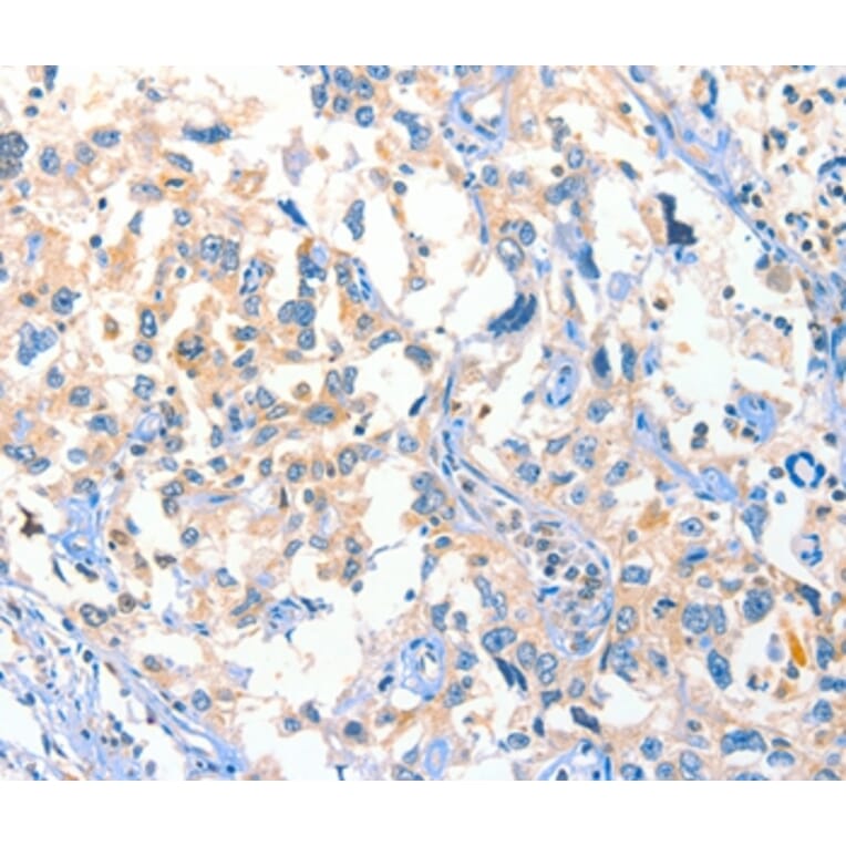 Immunohistochemistry - DUSP14 Antibody from Signalway Antibody (35730) - Antibodies.com