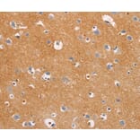 Immunohistochemistry - DUSP10 Antibody from Signalway Antibody (35732) - Antibodies.com