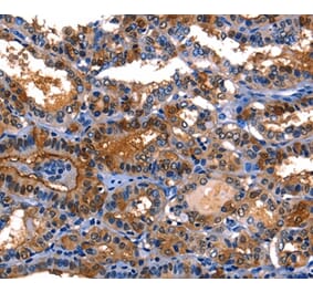 Immunohistochemistry - LGALS8 Antibody from Signalway Antibody (35748) - Antibodies.com