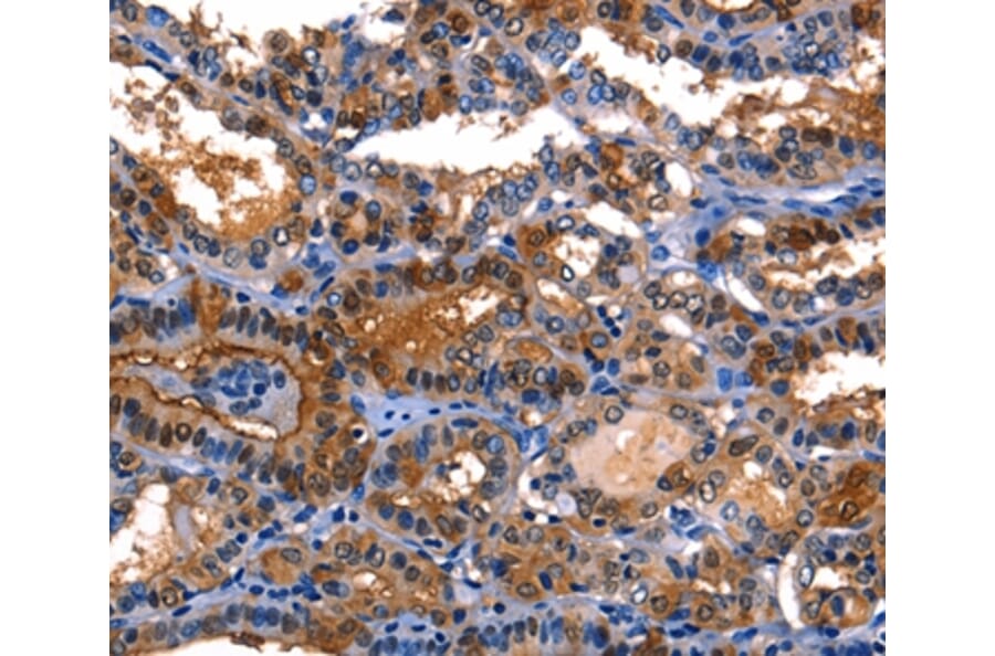 Immunohistochemistry - LGALS8 Antibody from Signalway Antibody (35748) - Antibodies.com