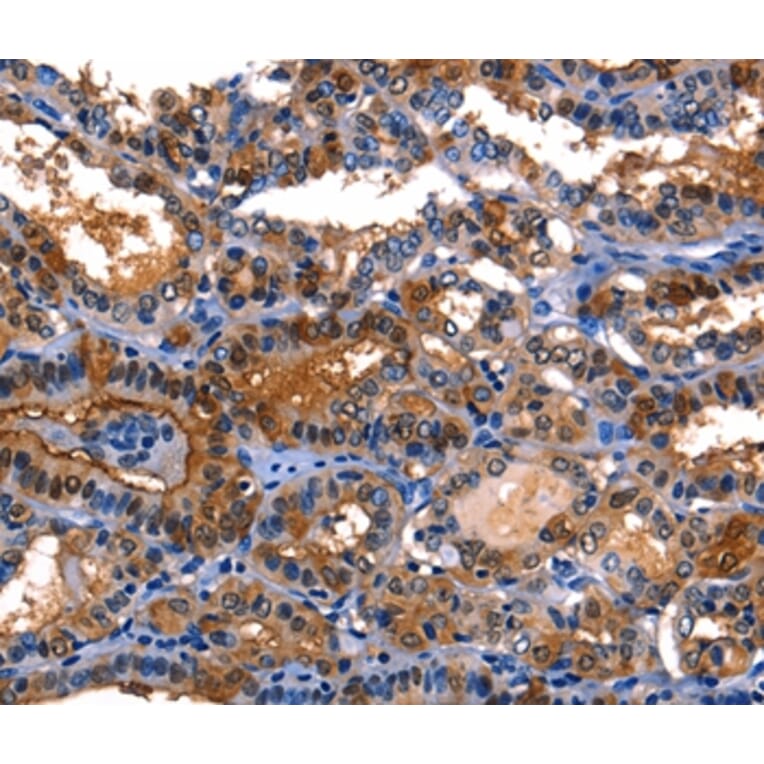 Immunohistochemistry - LGALS8 Antibody from Signalway Antibody (35748) - Antibodies.com